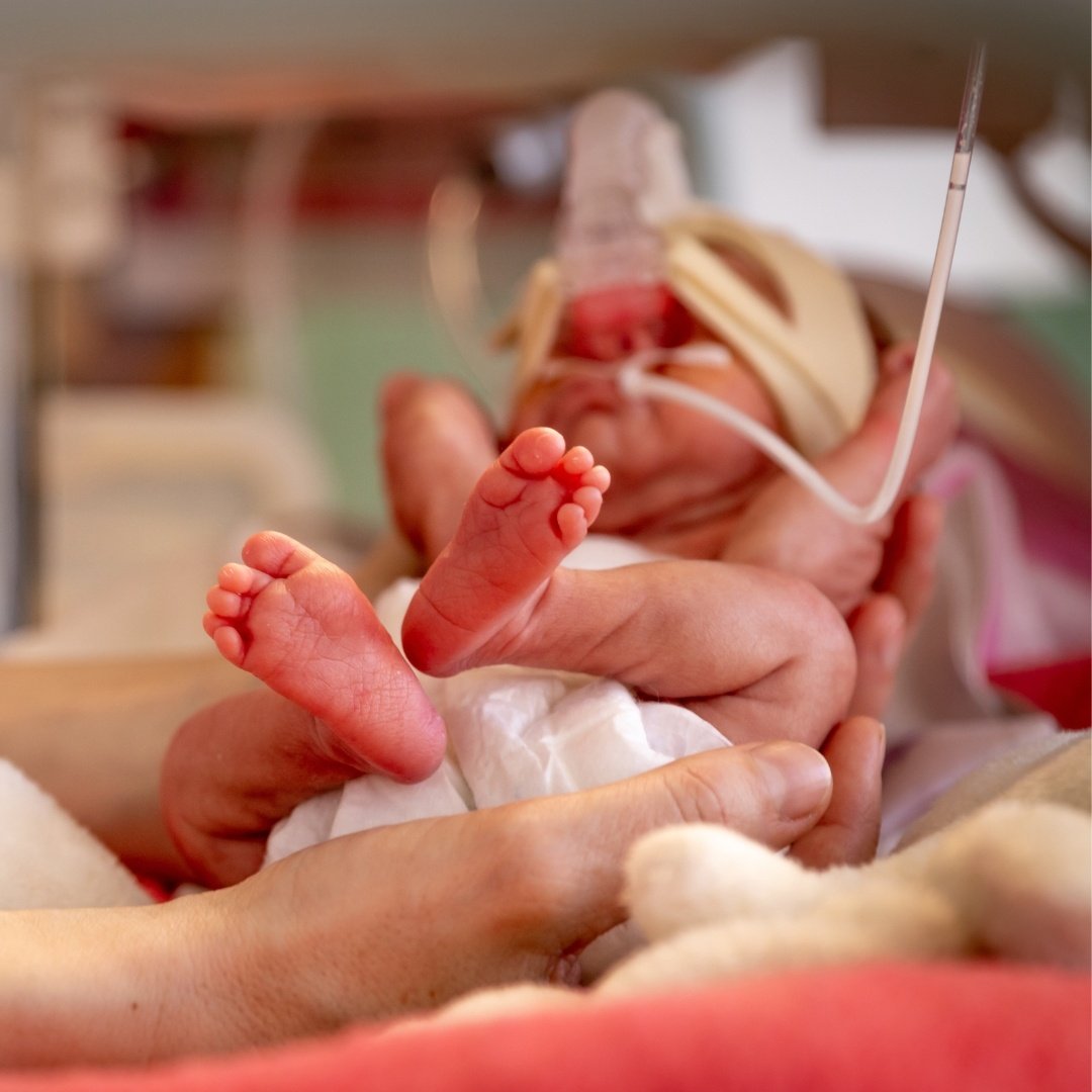 NICU baby image square