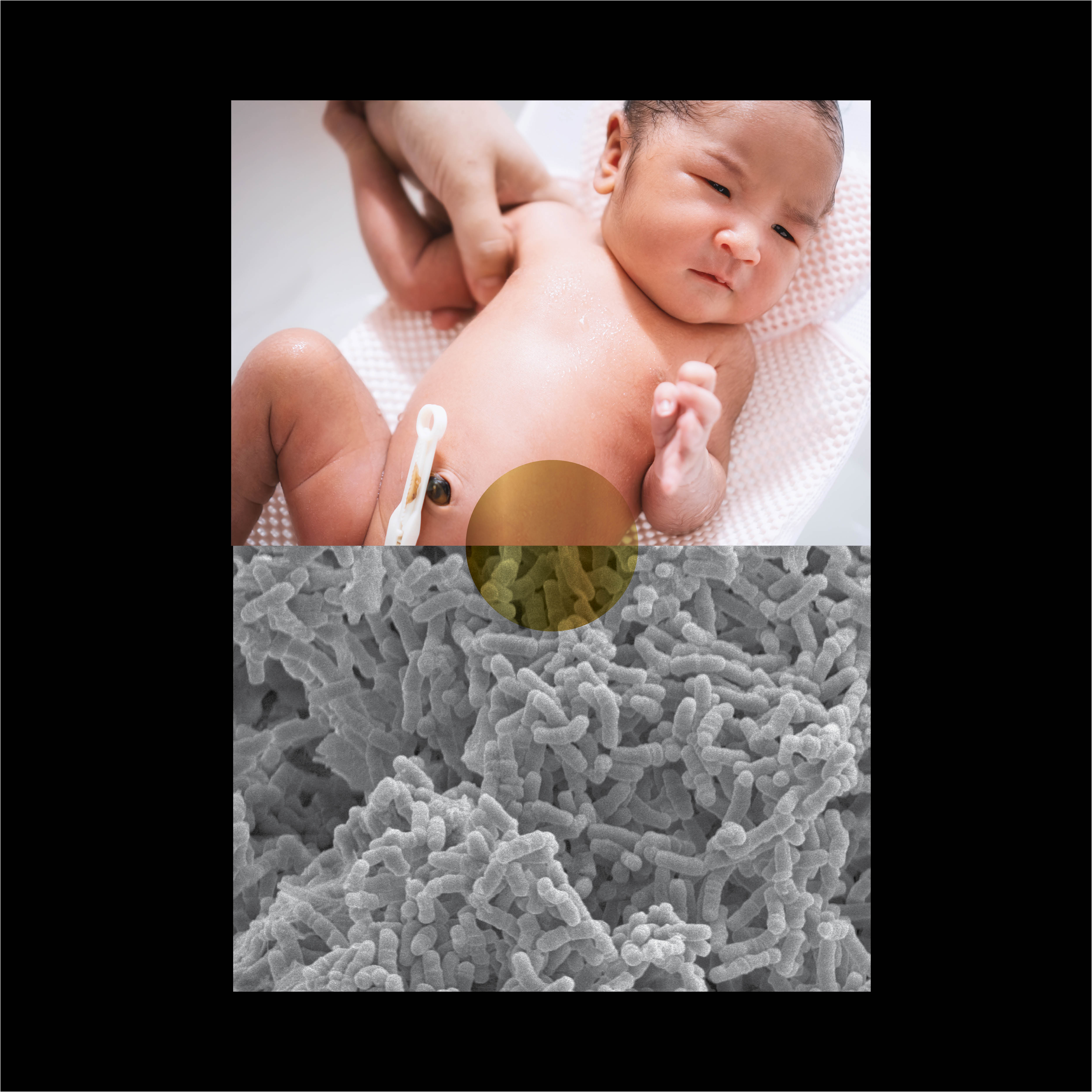 Baby with umbilical cord and bacteria collage